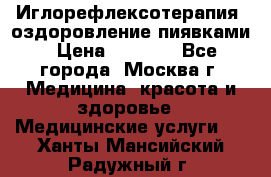 Иглорефлексотерапия, оздоровление пиявками › Цена ­ 3 000 - Все города, Москва г. Медицина, красота и здоровье » Медицинские услуги   . Ханты-Мансийский,Радужный г.